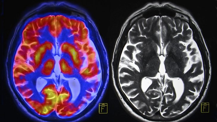 Researchers have developed an incredibly accurate technique using brain scans to measure the skill levels of professionals.
