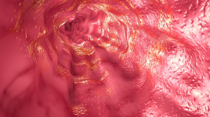 By middle age, over half the esophagus in healthy people has been taken over by cells containing mutations in cancer genes.