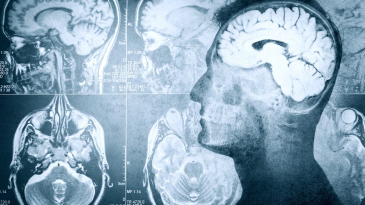 When people experience major injuries, their risk of being admitted for mental health disorders is significantly increased.