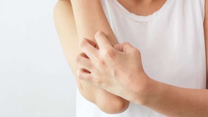 Researchers at the European Molecular Biology Laboratory (EMBL) may have found a new, less damaging way to scratch that itch.