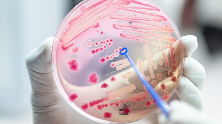 A collaborative study from the Institute of Infection Control and Infectious Diseases has shown an association between antimicrobial resistance and climate change.