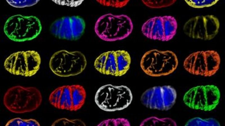 The first ever images of the cell-wide web have been captured by scientists at the University of Edinburgh thanks to computing techniques similar to those used for the first picture of a black hole. The findings reveal cells in the body are wired like computer chips to direct signals that instruct how they function. (Credit: The University of Edinburgh)