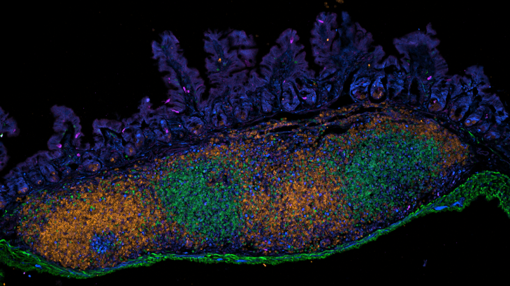 Age-related changes to the human gut microbiome have been linked to increased frailty, inflammation, and intestinal disorders.