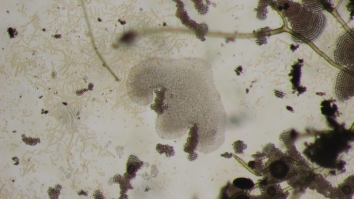 A collaborative team of scientists have found that Trichoplax actually lives in a complex symbiosis with a very unusual form of bacteria.