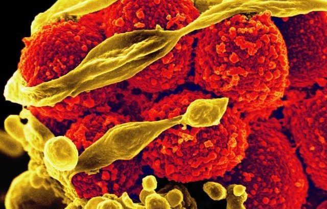 Antimicrobial resistance occurs when microorganisms like bacteria or viruses develop a resistance to the drugs used to eradicate them.