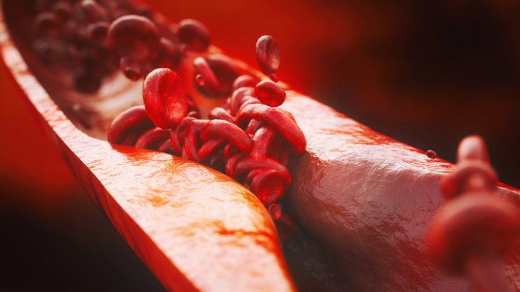 A new study suggests that the loss of a single gene over time is responsible for an increased risk of heart disease today.