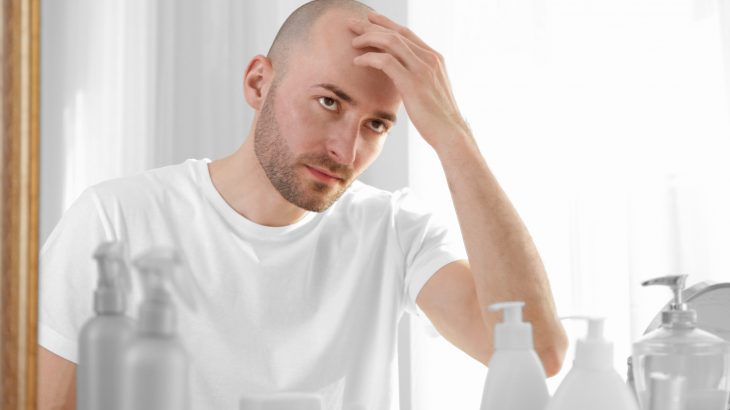 There’s promising new evidence that stem cell therapy and 3-D printing could offer an innovative solution to baldness.