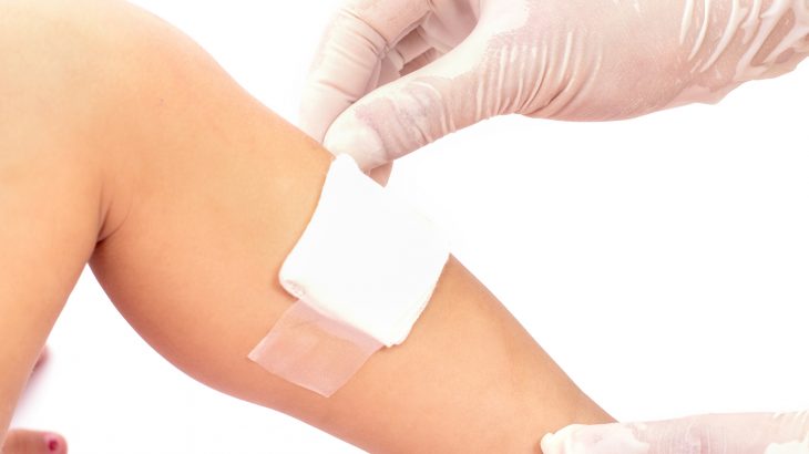 A team of engineers at Heriot-Watt University is developing a microsensor that can track changes in a wound as it heals.