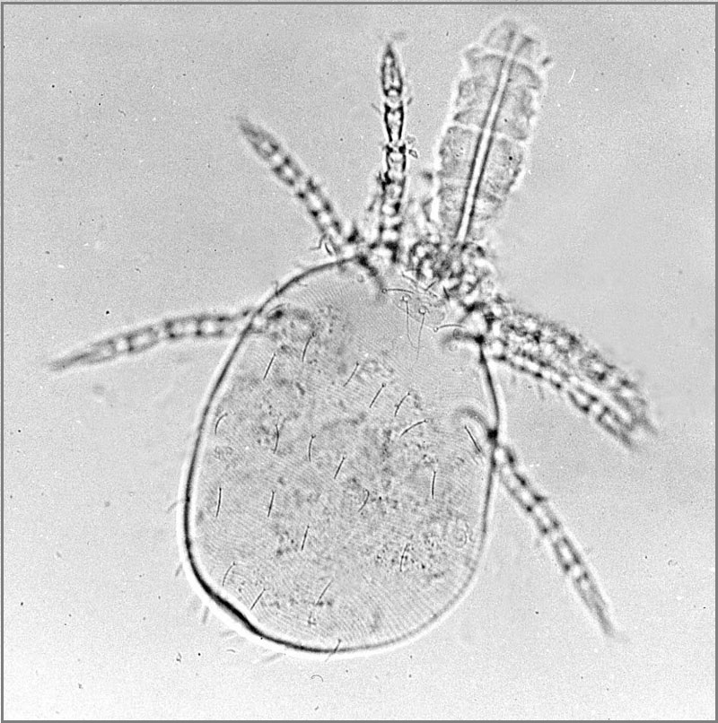 chigger chiggers trombiculidae mite larva