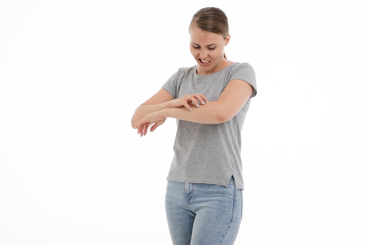itch woman bug bites