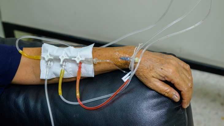 In a study from the Universal Health Network, a team of researchers led by Dr. Catherine O'Brien has found that cancer cells can transition into a dormant state when they are threatened by chemotherapy.