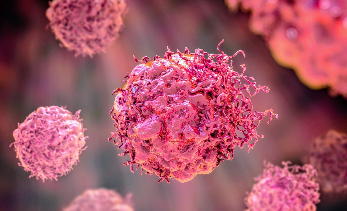 Scientists learn why cancer cells die, may transform treatment - Earth.com