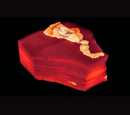 medium thumb with excerpt image