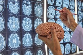 News article thumbnail