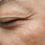 Scientists finally find how wrinkles form when skin ages
