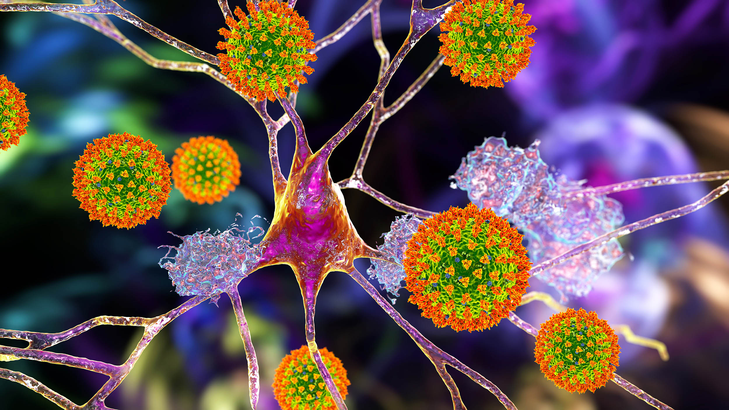 Covid aged our brains, even if you weren’t infected