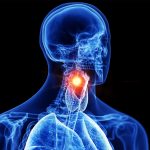 AI may diagnose voice box cancer just by listening to your voice