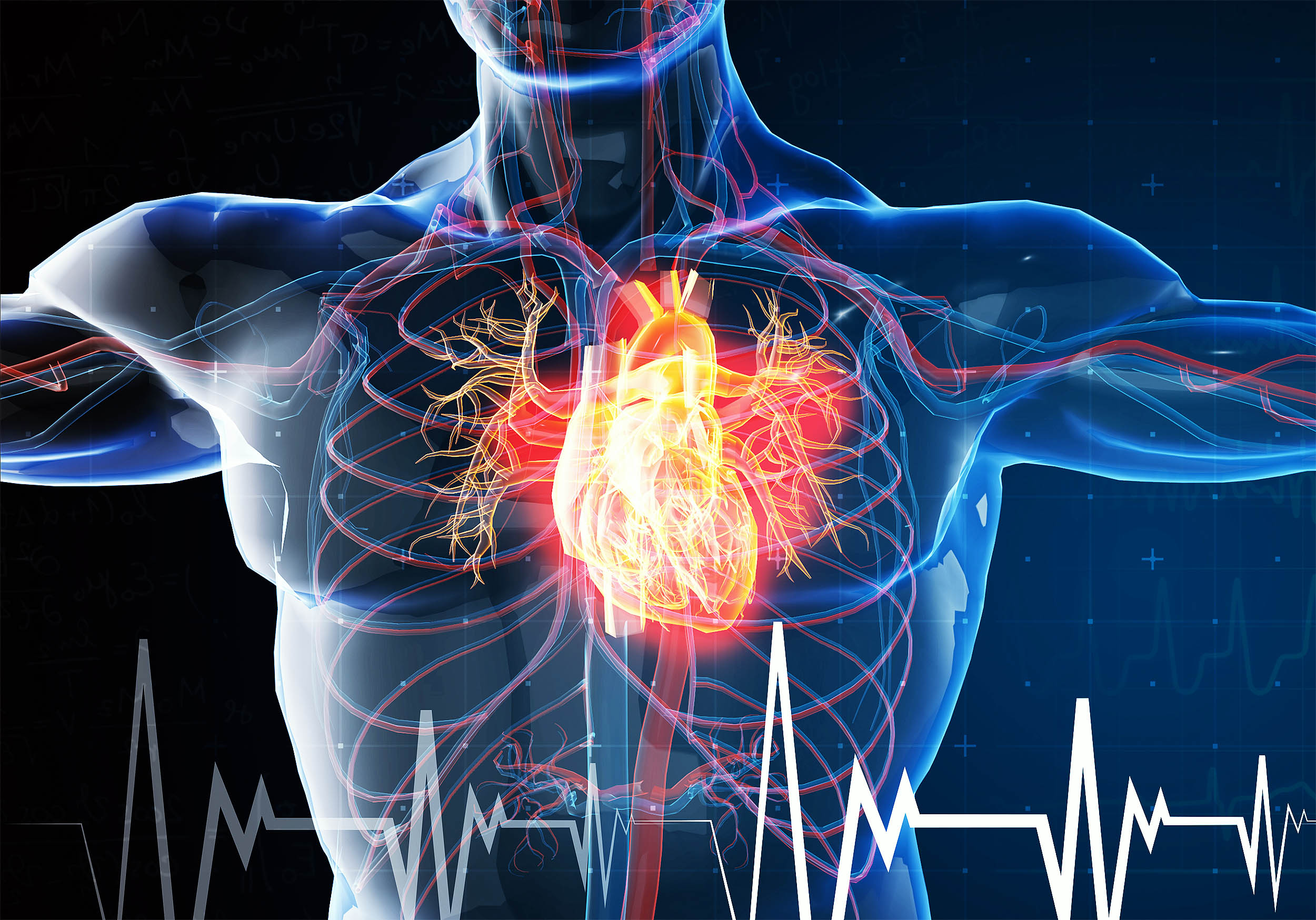 Study concludes that heart attacks “may be an infectious disease”