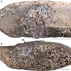 In the approximately 80-million-year-old fossilized bone, the arrows indicated by BL point to the lesion caused by osteomyelitis. HB is the unlesioned part, and MB is the bone marrow. Credit: Tito Aureliano et al./The Anatomical Record