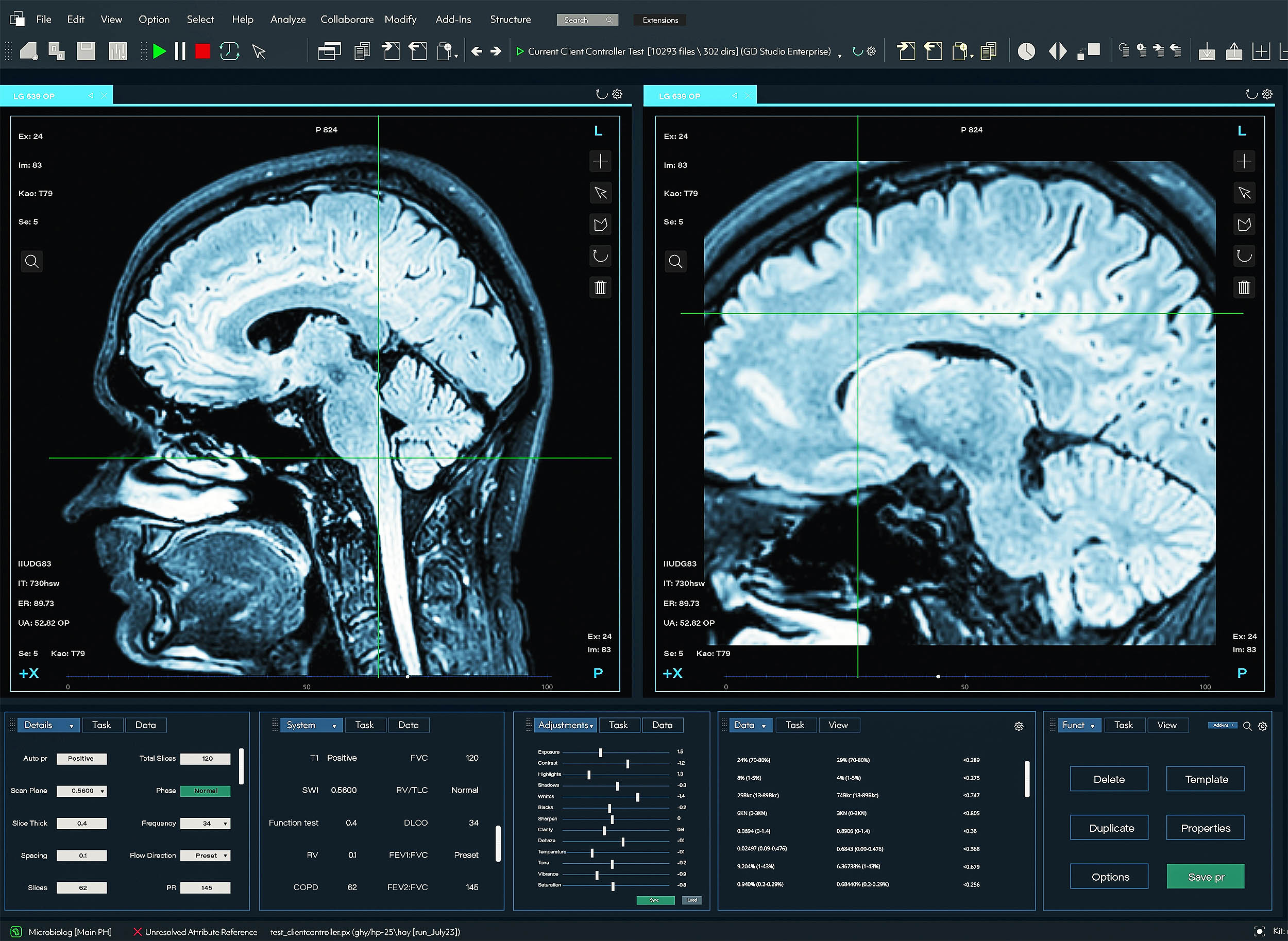 Эрдэмтэд хүний тархи хэдэн насандаа танин мэдэхүйн хяналтаа алдаж эхэлдгийг тогтоолоо