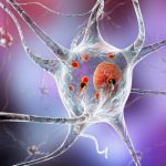 Tiny holes in brain cells may unlock the mystery of Parkinson’s