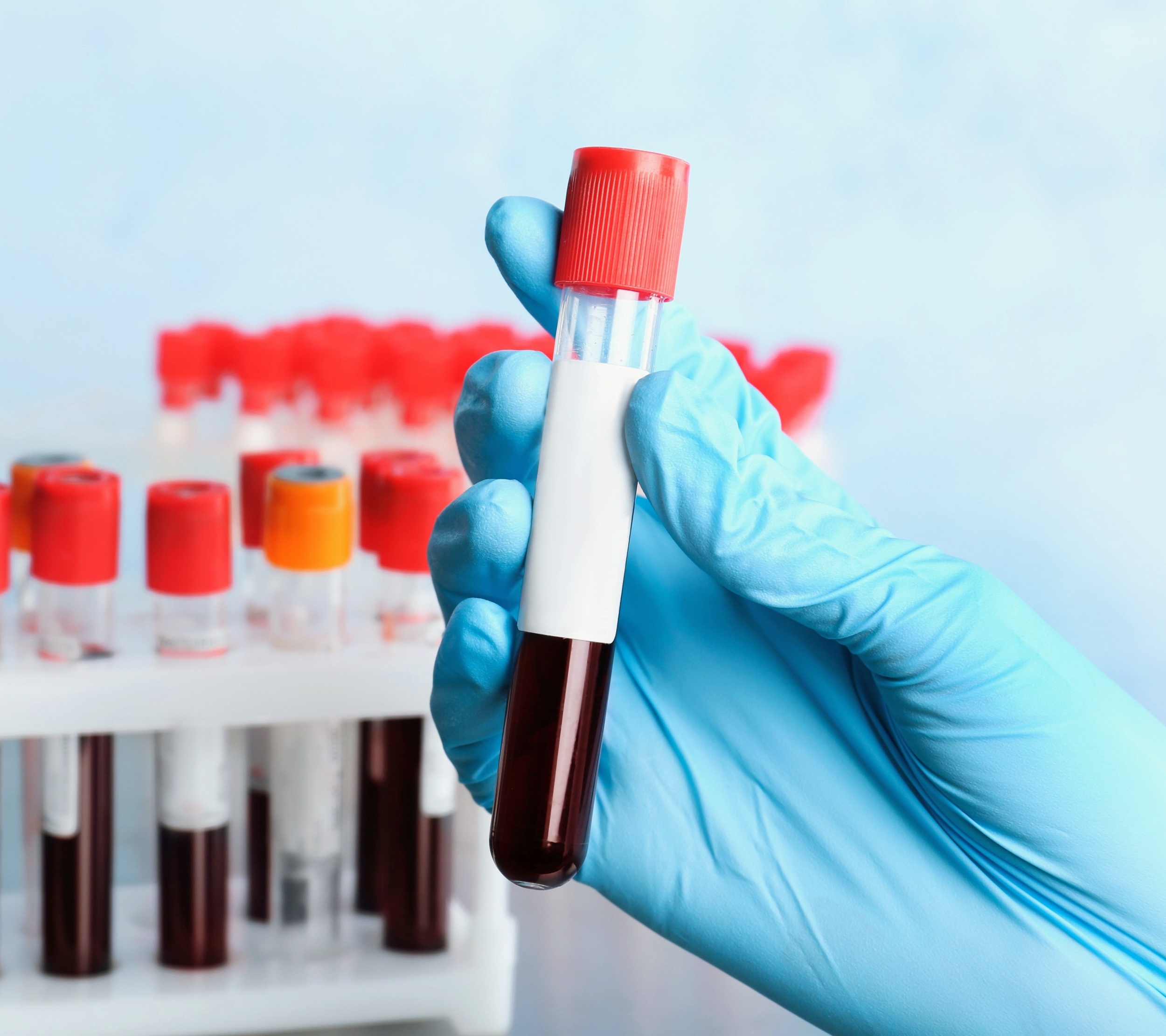 Simple blood test could spot health risks years before symptoms