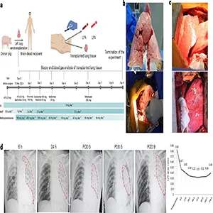 Experimental outline and surgical and clinical features of the pig-to-human lung xenotransplantation procedure. Credit: Nature Medicine
