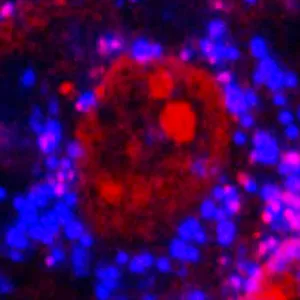 A micrograph taken at 400x magnification shows the interior of an MG-63 bone cell. Small polystyrene microplastic spheres appear inside the cytoplasm and are highlighted in blue. The cell nucleus is shown in red Credit: Mariana Cassani de Oliveira/LEMON/FCM-UNICAMP