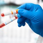 New blood test shows how fast our organs are aging