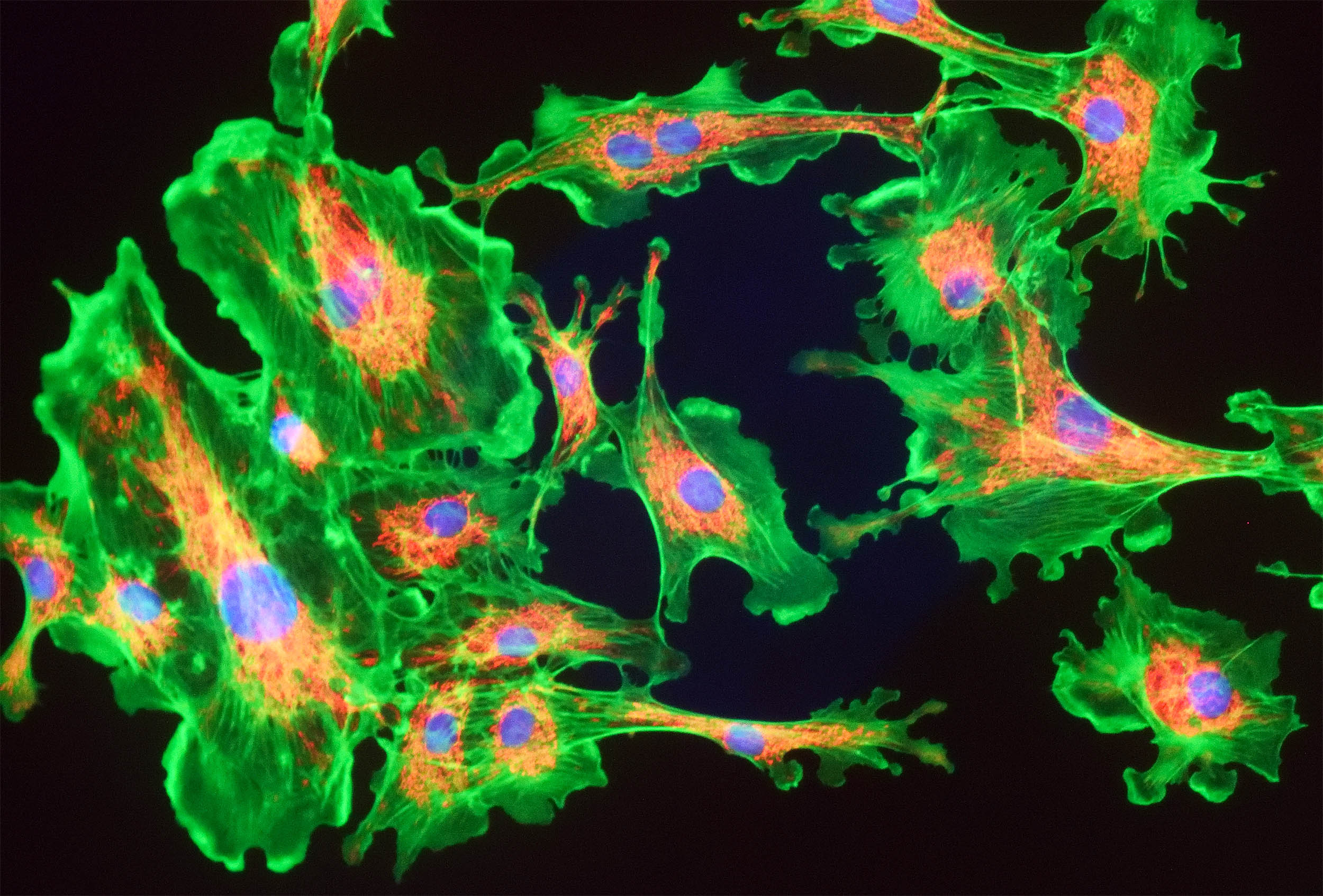 Memory loss is reversed by ‘activating’ the mitochondria in the brain
