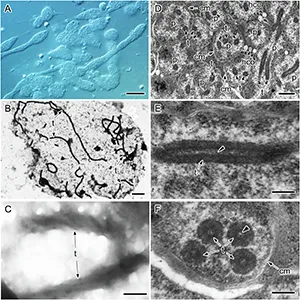 A Isolated Profftella cells observed under an DIC microscope. B, C Tubes in ruptured but unfixed Profftella observed by TEM. D–F TEM observation of ultrathin sections of chemically fixed and resin-embedded Profftella cells and tubes. Numerous Profftella cells are packed in a syncytium of the D. citri bacteriome (D). Longitudinal view of a tube (E). Cross-sectional view of the tubes (F). p, Profftella; t, tube; cm, cell membrane of Profftella. Credit: npj Imaging