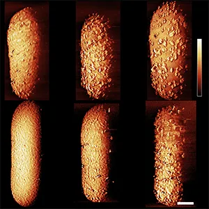 Images of E. coli bacteria exposed to the polymyxin antibiotic. Changes to the outer layer of armor are evident over time in the images, progressing from left to right. Credit: Carolina Borrelli, Edward Douglas et al. / Nature Microbiology