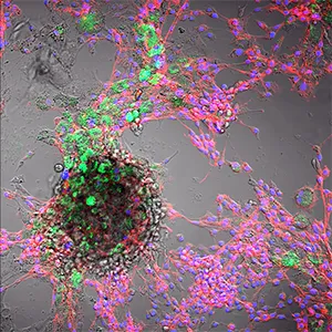 Combined bright field and fluorescence microscopy of bovine cells: cell nuclei (blue, DAPI), cytoskeleton (red, phalloidin) and absorbed polystyrene nanoplastics (green, 100 nm). Credit: FBN