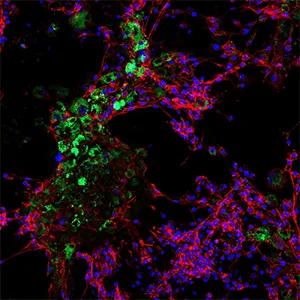 Granulosa cells from bovine ovaries after eight days of contact with nanoplastics particles. The fluorescent polystyrene particles (100 nm) show how the cells absorb the nanoplastics. Credit: FBN