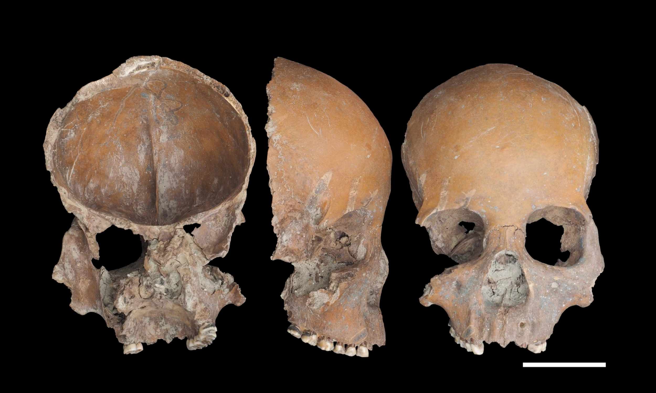 Unbelievable Discovery: Ancient Chinese City Used Human Bones as Everyday Tools!