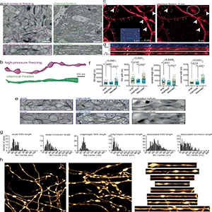 Pearled membrane morphology is observed for all axons except after chemical fixation. (a) Example micrographs showing acutely extracted mouse brain tissue either high-pressure frozen (left) or chemically fixed (right). The boxed axons are reconstructed. Note that chemically fixed axons are like cylindrical tubes. (h) Additional STED micrographs showing pearled axon morphology in live neurons from organotypic slice cultures. Scale bar: 500 nm. Individual axons are straightened and represented on the right panels. Credit: Nature Neuroscience