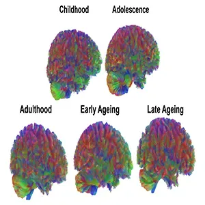 All Eras: Representative MRI tractography images of all eras of the human brain. Credit: Dr Alexa Mousley, University of Cambridge. Click image to enlarge.