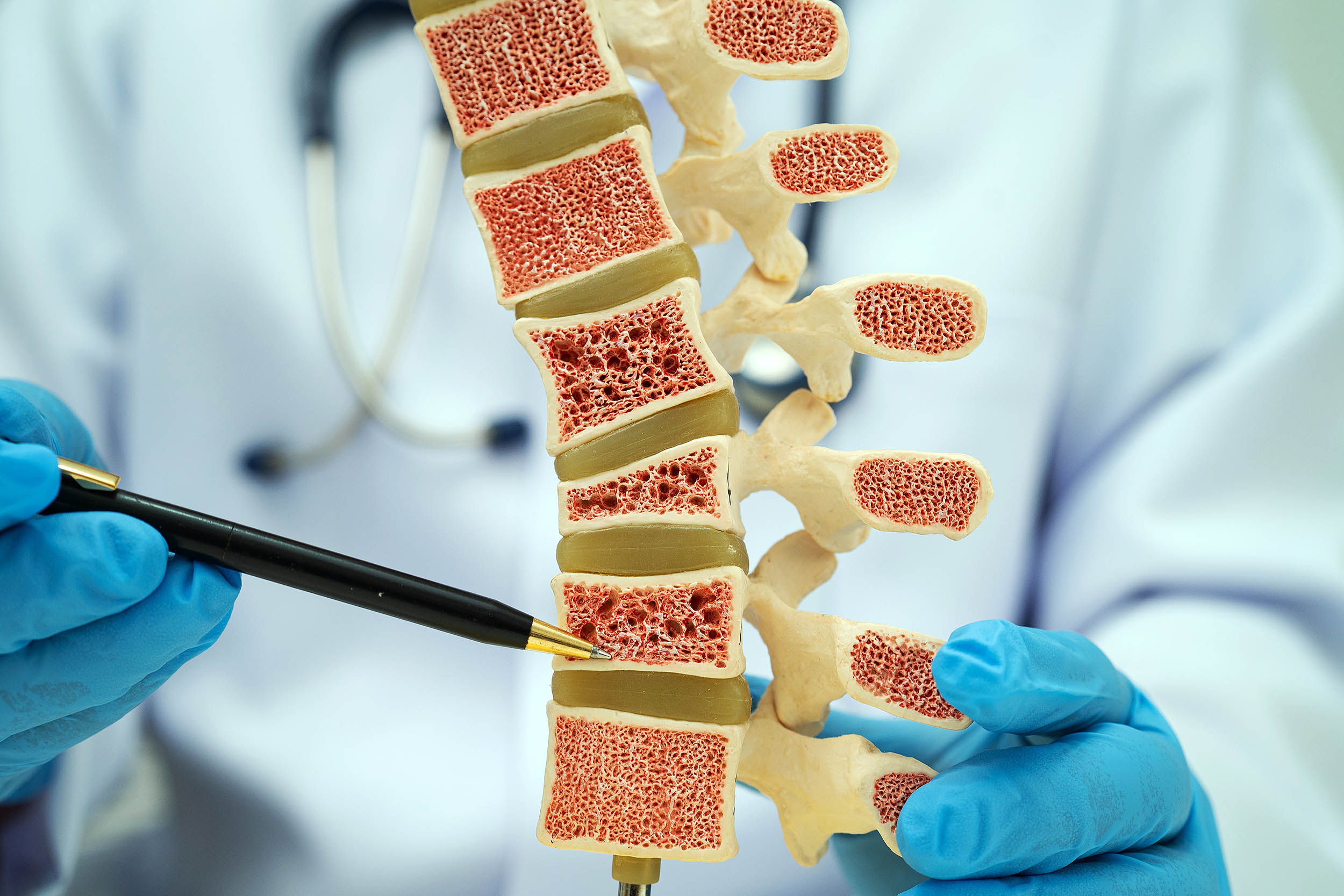Remarkable discovery finds way for bones to repair themselves, reversing osteoporosis