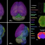 Confirmed: new technology successfully eliminates Alzheimer's symptoms by restoring the brain's natural defenses