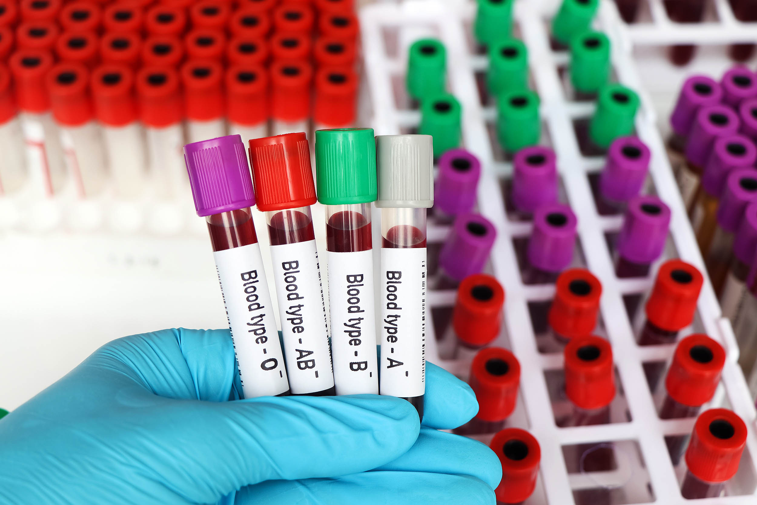 Scientists discover a surprising link between blood type and stroke risk