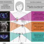 Why many women confuse the first symptom of ovarian cancer with simple weight gain