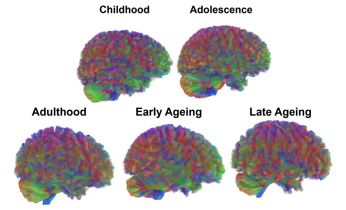 Scientists Map Five Different and Distinct Stages of Human Brain Aging