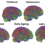 Scientists map five different stages of human aging throughout life. Credit: Dr. Alexa Mousley, University of Cambridge