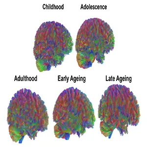 All Eras: representative MRI tractography images of all eras of the human brain. Credit: Dr Alexa Mousley, University of Cambridge