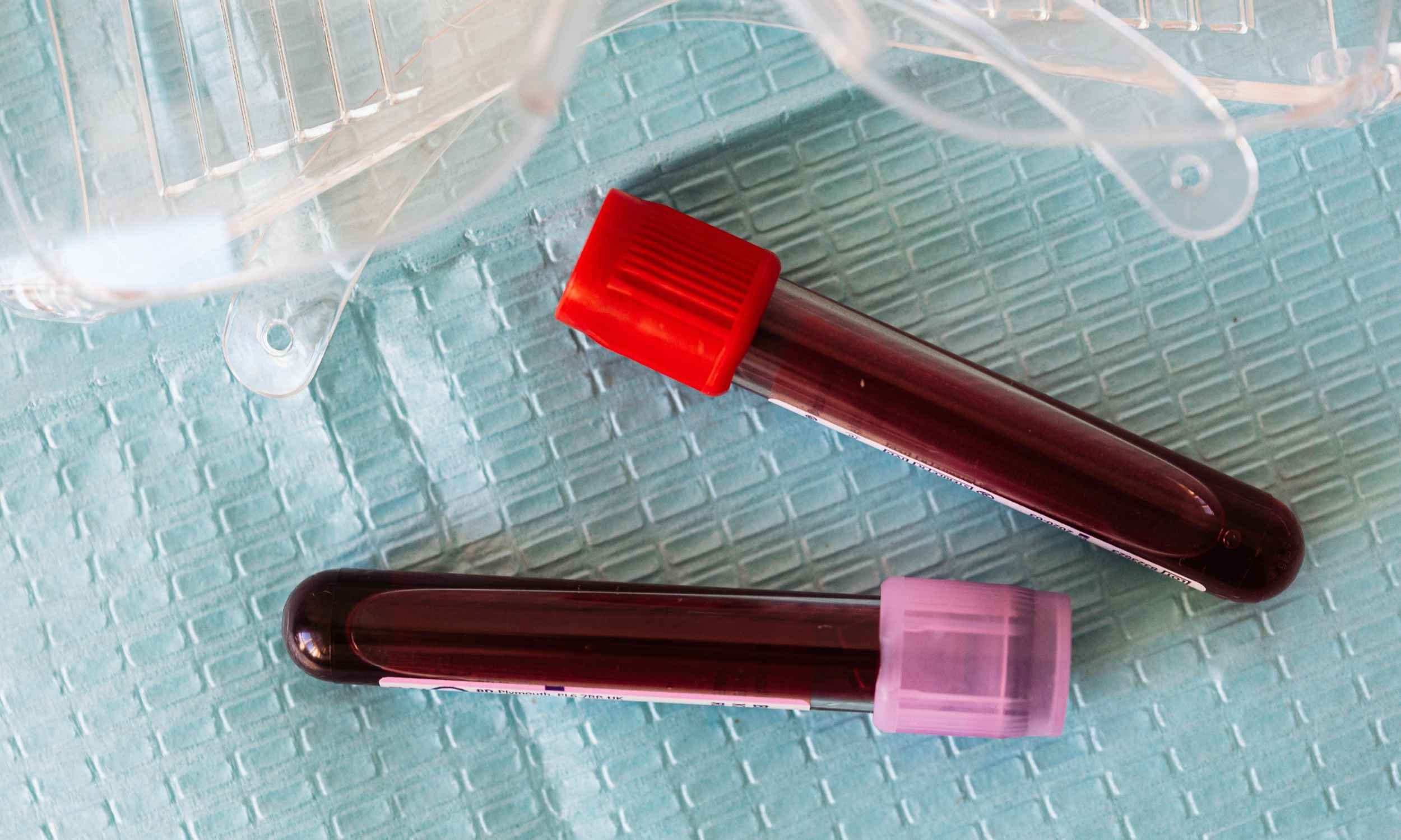 Woman discovers that her blood is genetically male, baffling the scientific community