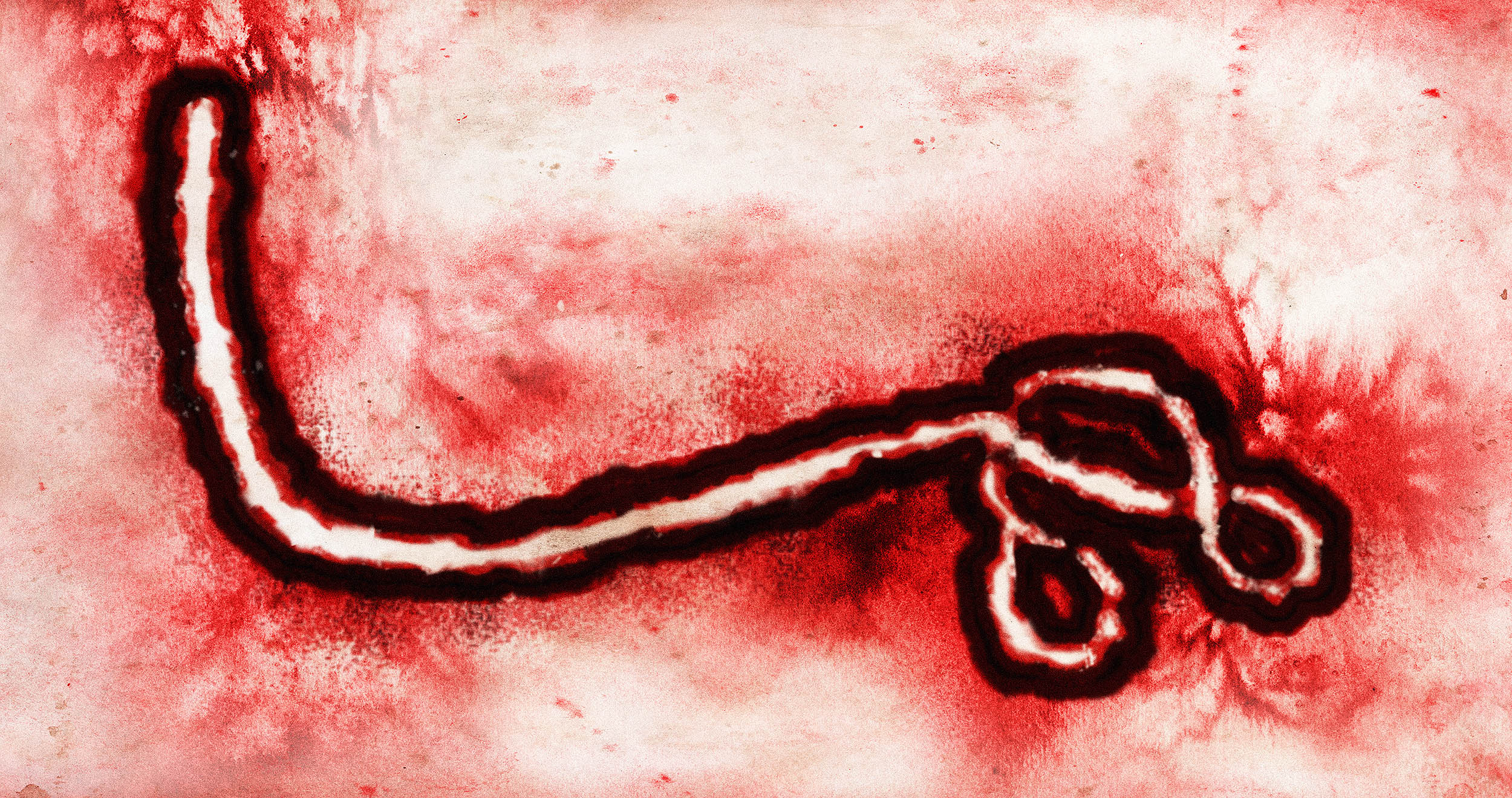 Ebola-related virus in Ethiopia has the WHO highly concerned