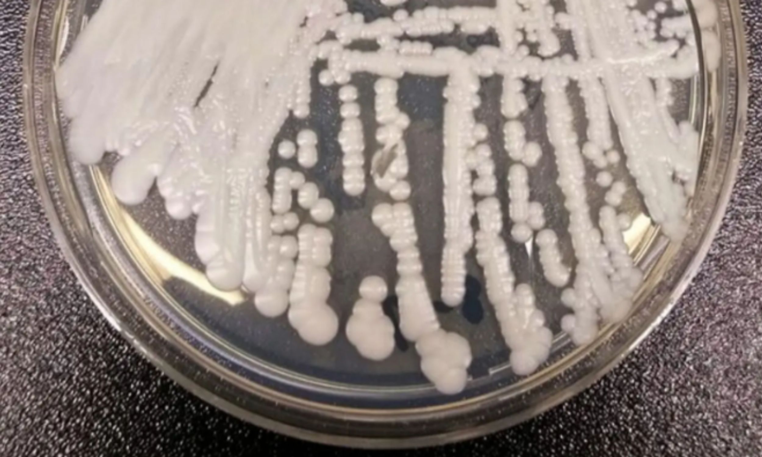 Key enzyme helps a drug-resistant fungus thrive on human skin
