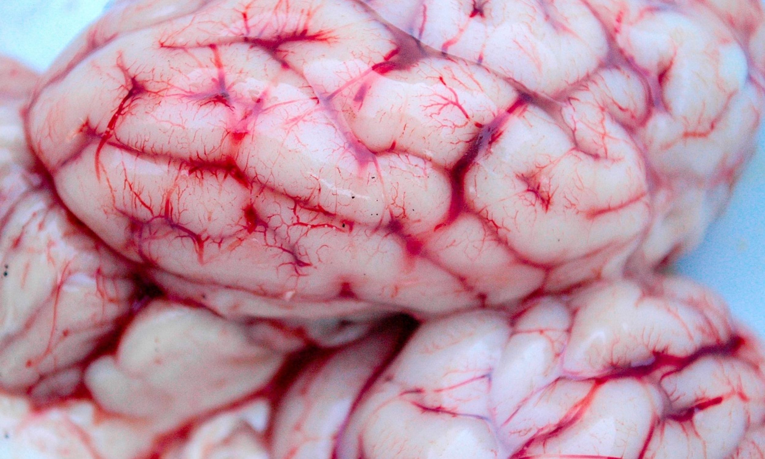 New map of fetal brain cell development may change our understanding of mental illness and cancer