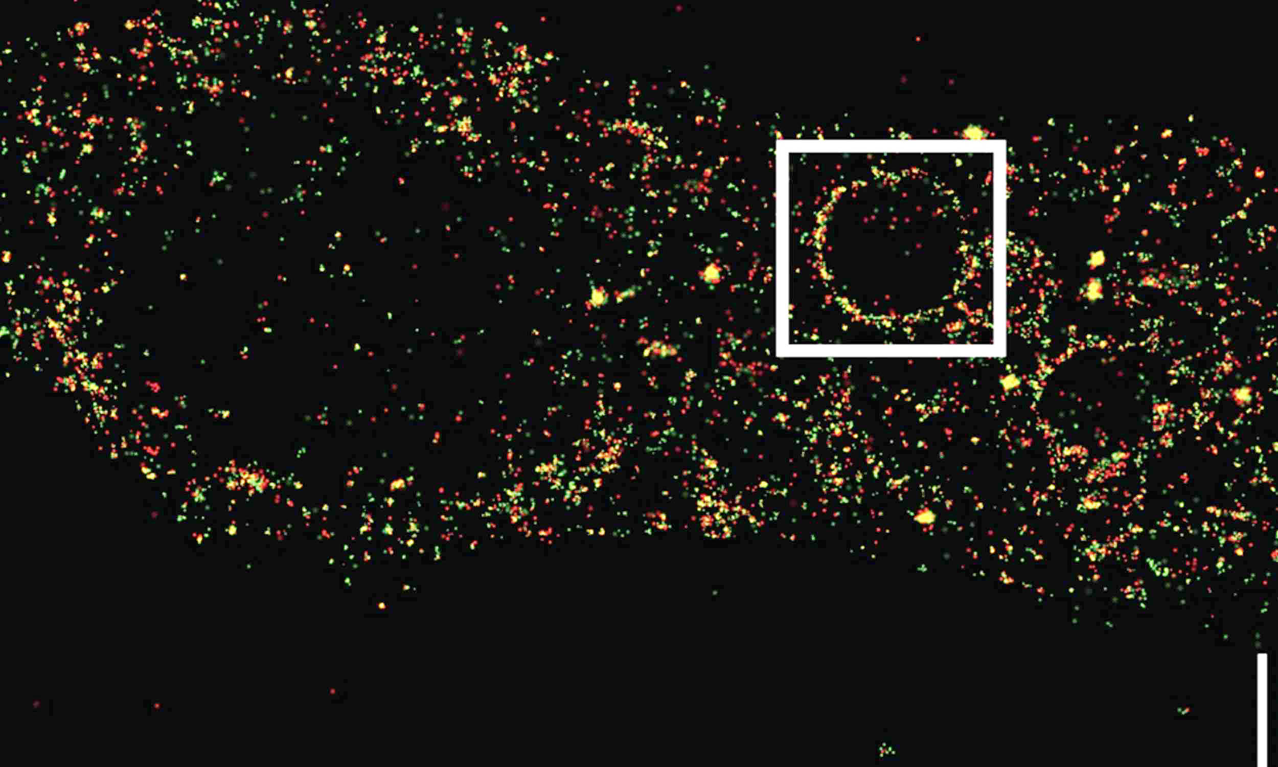 Hidden lipid in cells revises our understanding of how the body eliminates threats