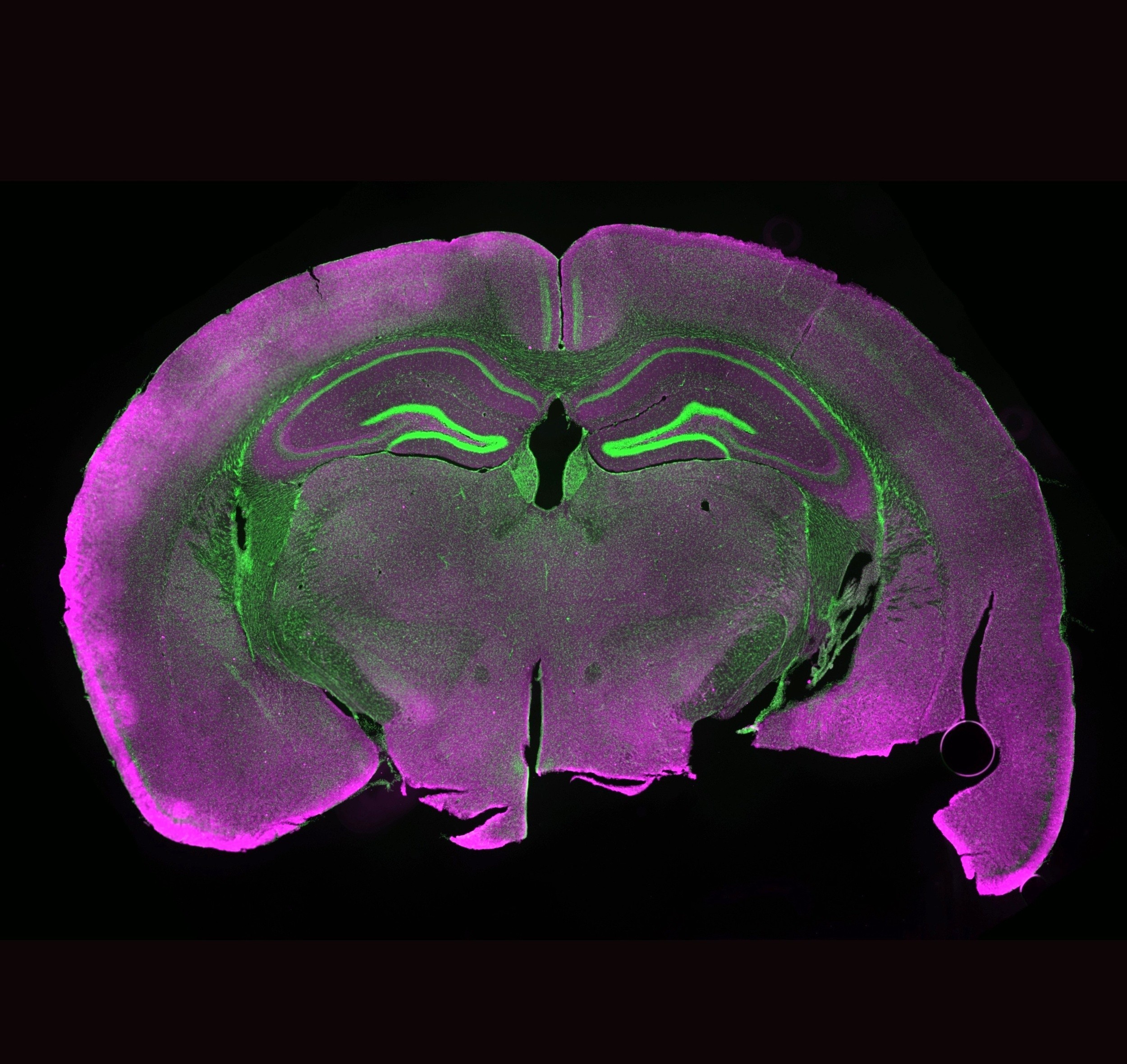 Frozen mouse brains show signs of life after thawing
